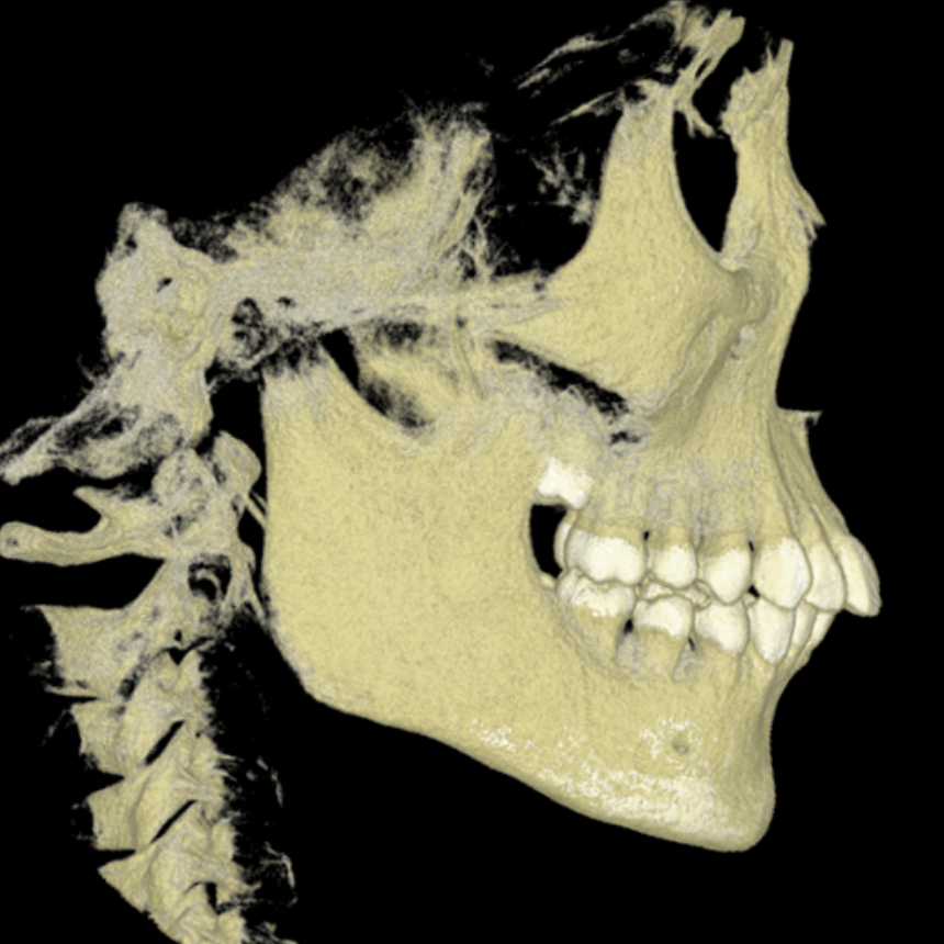 出っ歯の矯正治療 ブログ 美しい歯を手に入れるなら自由が丘シーズ歯科 矯正歯科