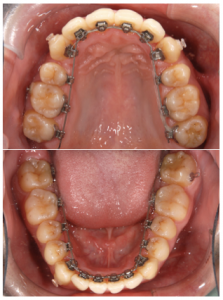 スクリーンショット 2026-01-30 15.13.34