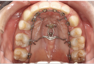 スクリーンショット 2026-01-30 15.33.32