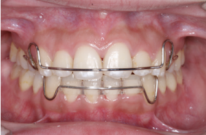 スクリーンショット 2026-02-08 9.27.05