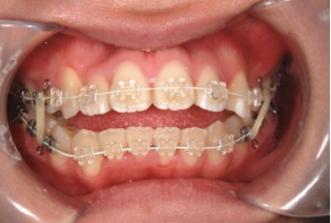 スクリーンショット 2026-02-09 13.21.43