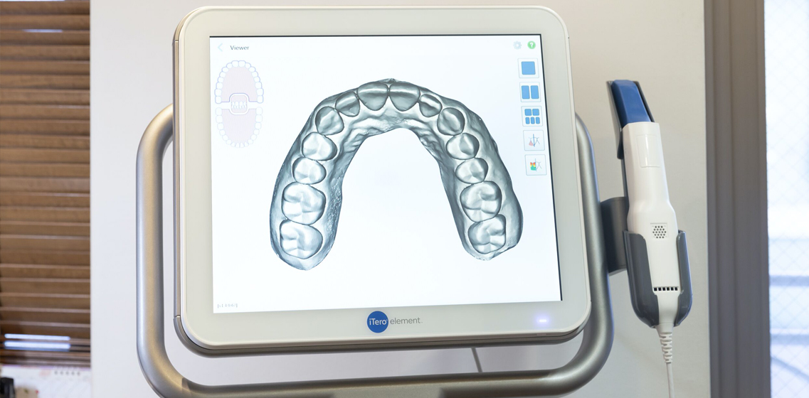口腔内3Dスキャナー